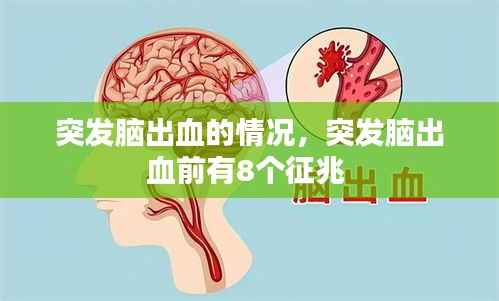 突发脑出血的情况,突发脑出血前有8个征兆