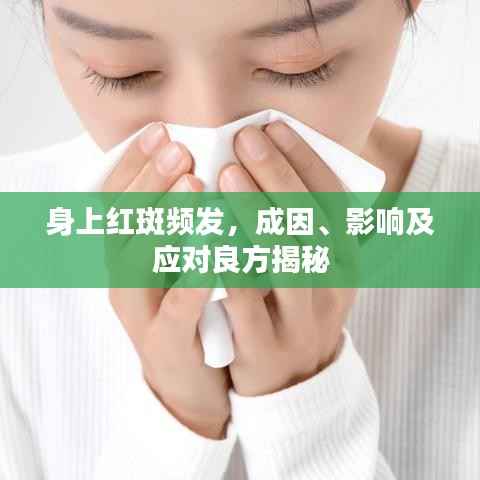 身上红斑频发,成因、影响及应对良方揭秘